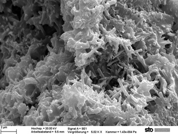 Die Aufnahme mit dem Raster-Elektronenmikroskop zeigt die mikroskopische Struktur der Epoxy-Hybrid-B